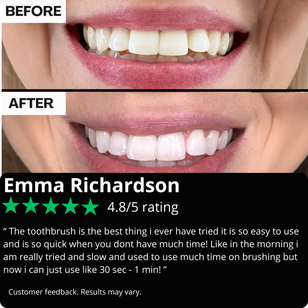 DoLoBrush–Deep Clean and Gentle Whitening